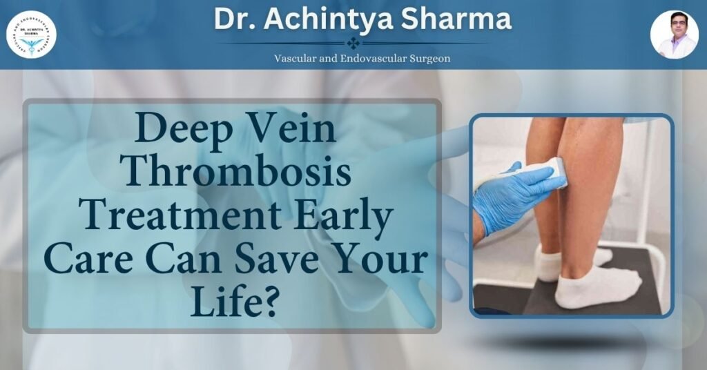 Deep Vein Thrombosis Treatment Early Care Can Save Your Life?