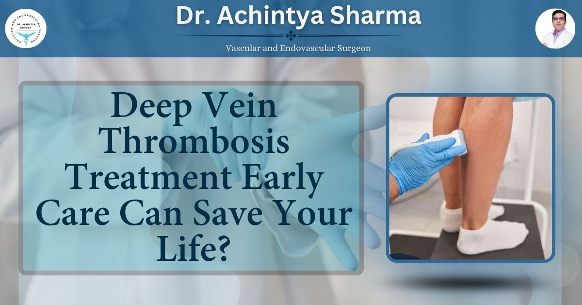 You are currently viewing Deep Vein Thrombosis Treatment Early Care Can Save Your Life?