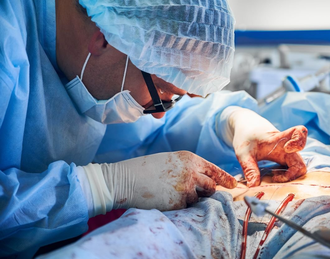 Surgery