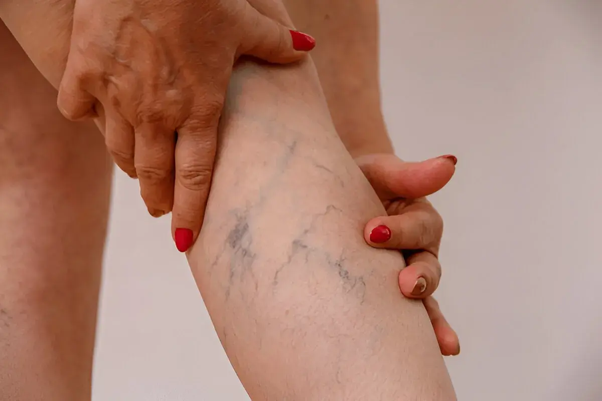 Laser treatment