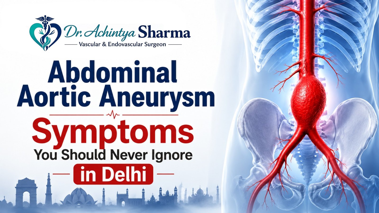 Home 2 Medical illustration showing an abdominal aortic aneurysm with enlarged abdominal aorta and the text "Abdominal Aortic Aneurysm Symptoms You Should Never Ignore in Delhi" by Dr. Achintya Sharma, Vascular & Endovascular Surgeon.