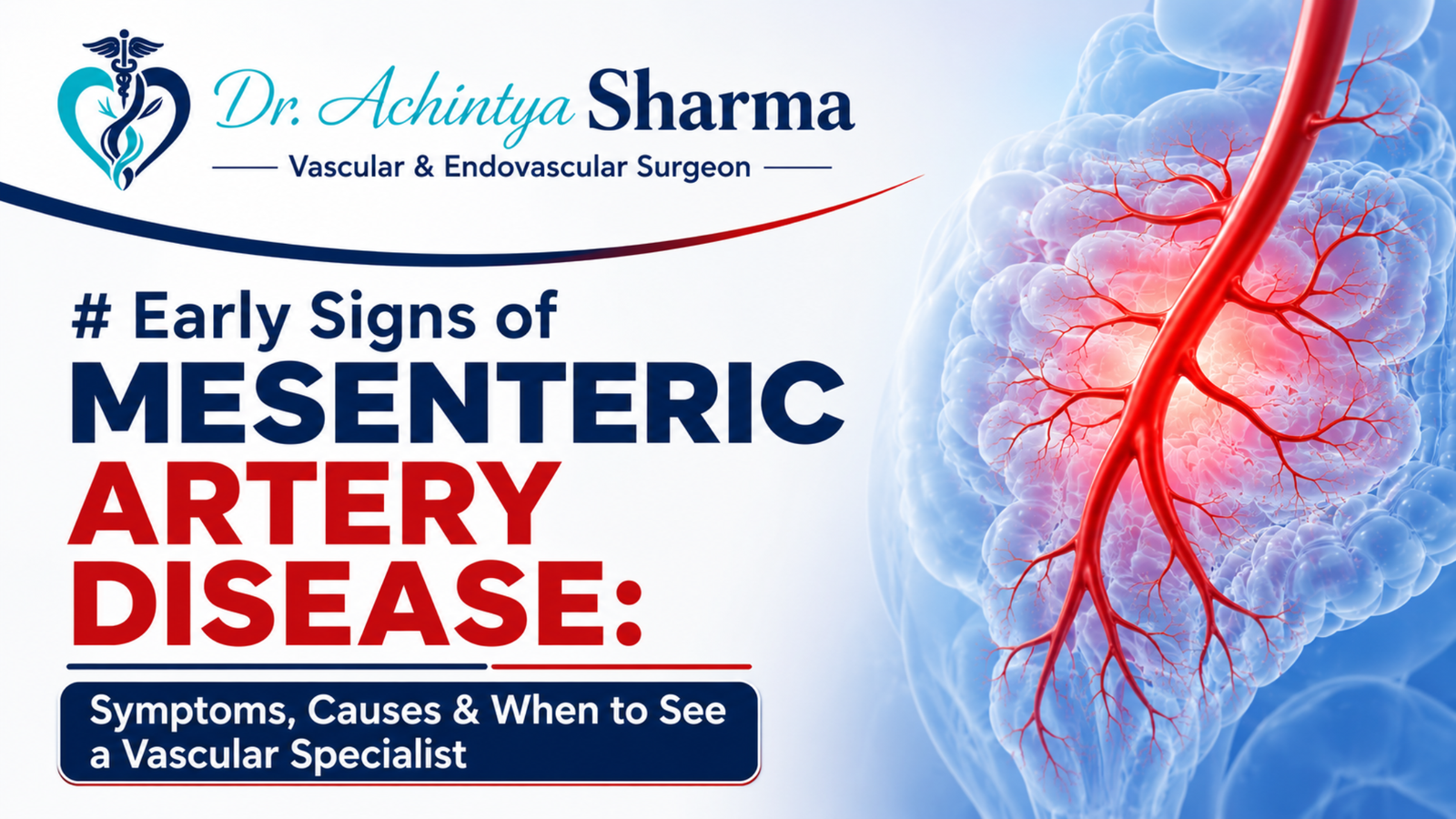 Early Signs of Mesenteric Artery Disease – Symptoms, Causes and Vascular Specialist