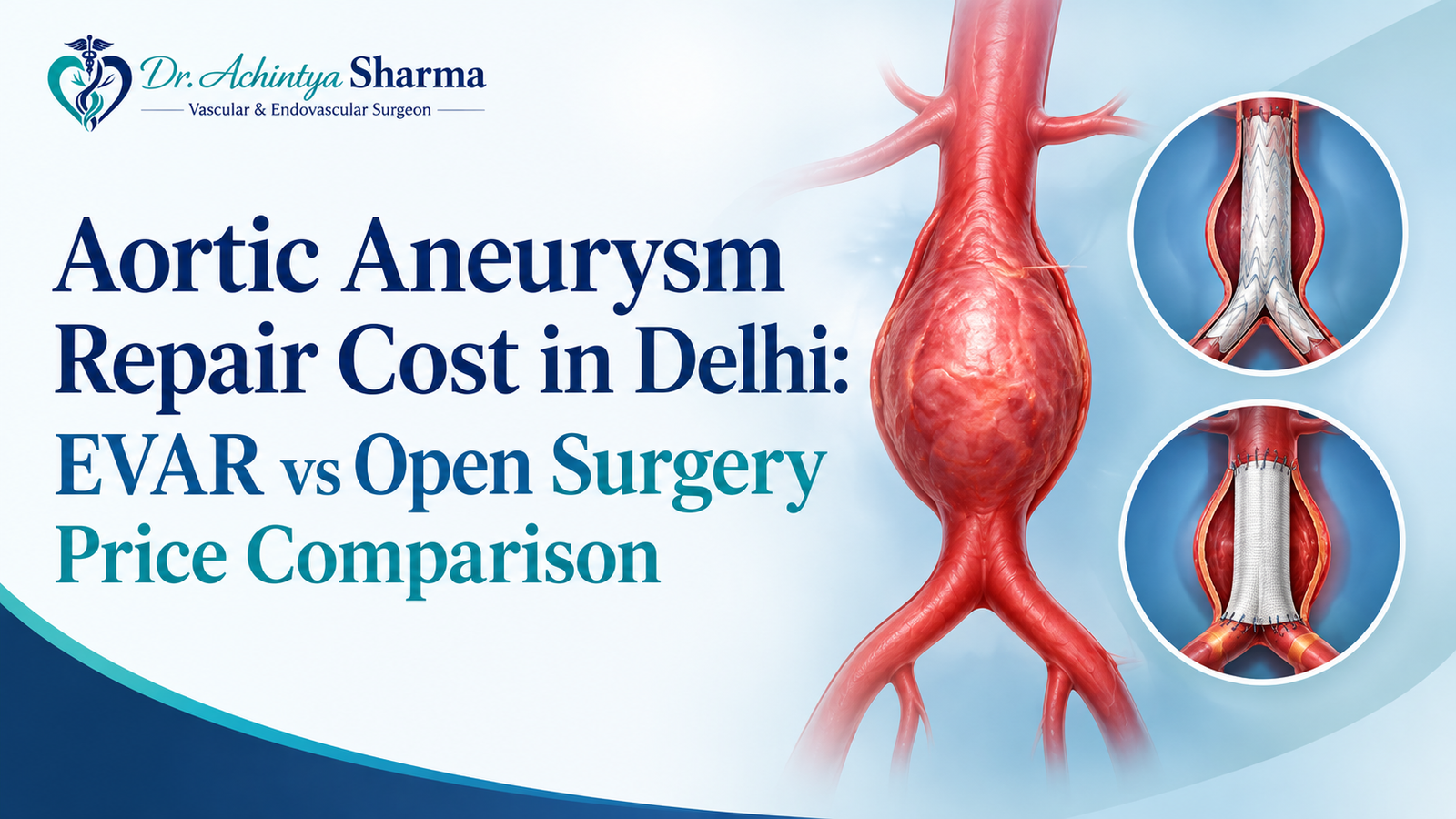Aortic aneurysm repair in Delhi showing EVAR stent-graft and open surgery comparison with Dr. Achintya Sharma logo.