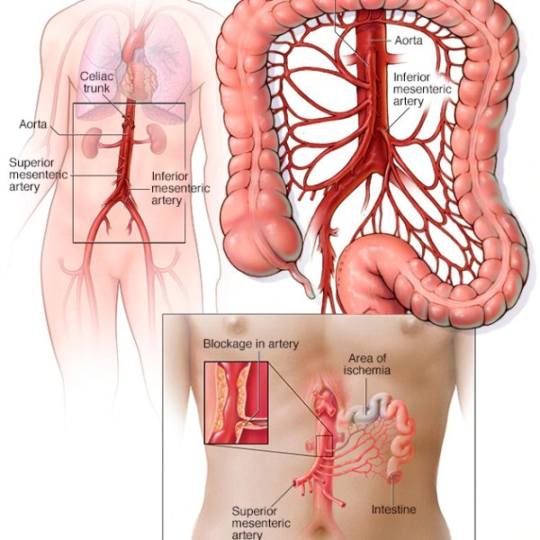 mesenteric-arterial-circulation-8col-3069409-001-0